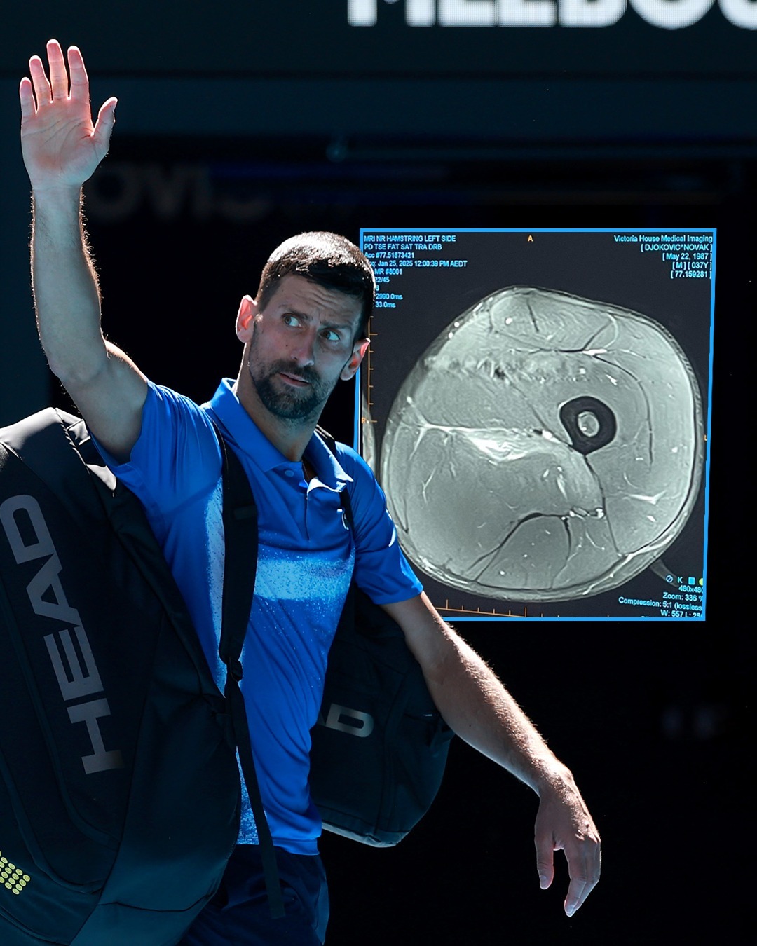 关于美网碾压拉沃尔杯,德约科维奇状态火热的信息 关于美网碾压拉沃尔杯,德约科维奇状态火热的信息